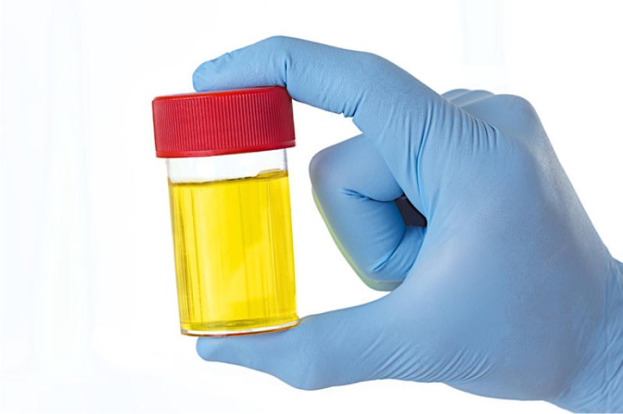 Synthetic Urine And Dot Drug Tests Troy AL 36079
